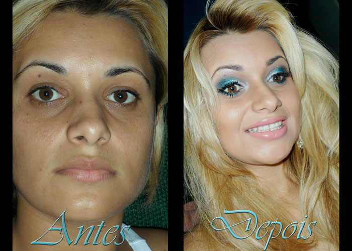 Antes-Depois