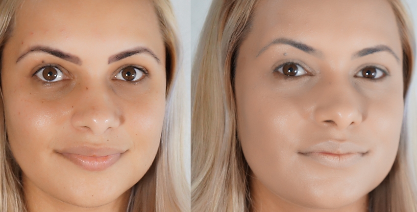 1-antes depois