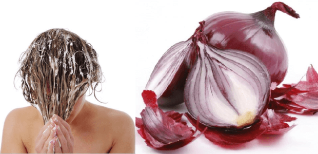 cebola para fazer o cabelo crescer mais rapido
